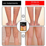 Parche terapéutico Varicose 2x1 ¡GRATIS el 2.º! Promoción Activa