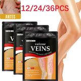 Parche terapéutico Varicose 2x1 ¡GRATIS el 2.º! Promoción Activa