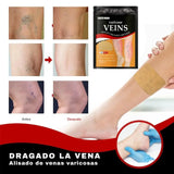 Parche terapéutico Varicose 2x1 ¡GRATIS el 2.º! Promoción Activa